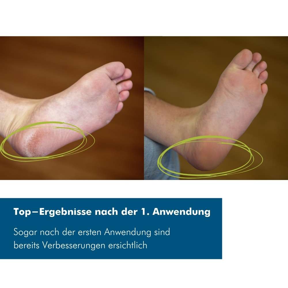 Lopalmed Hand- und Fußpflege-Box pflegt trockene Haut