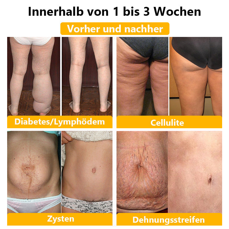 Anyidea® medizinische Titanfaser-Shaping-Shorts