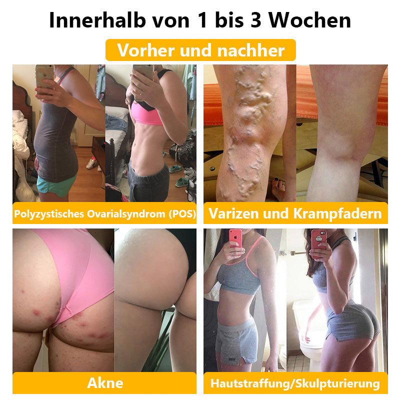 Anyidea® medizinische Titanfaser-Shaping-Shorts