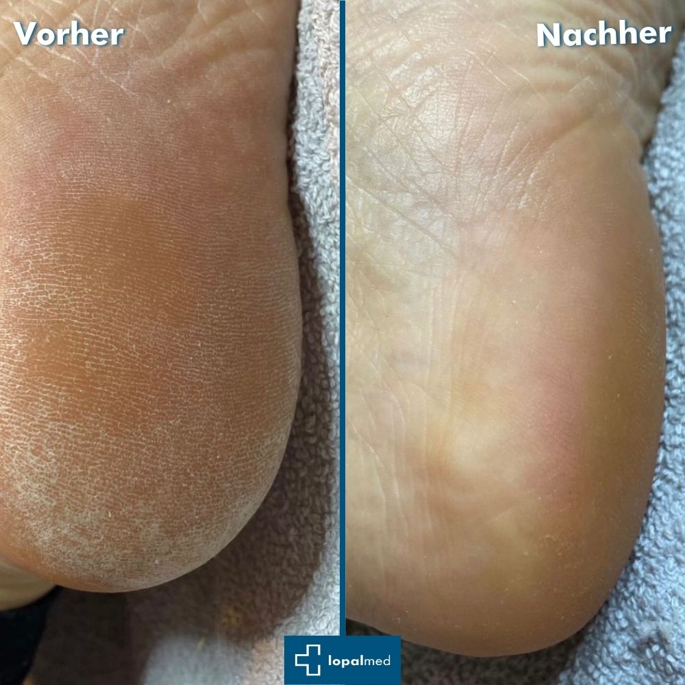 Lopalmed Hand- und Fußpflege-Box pflegt trockene Haut