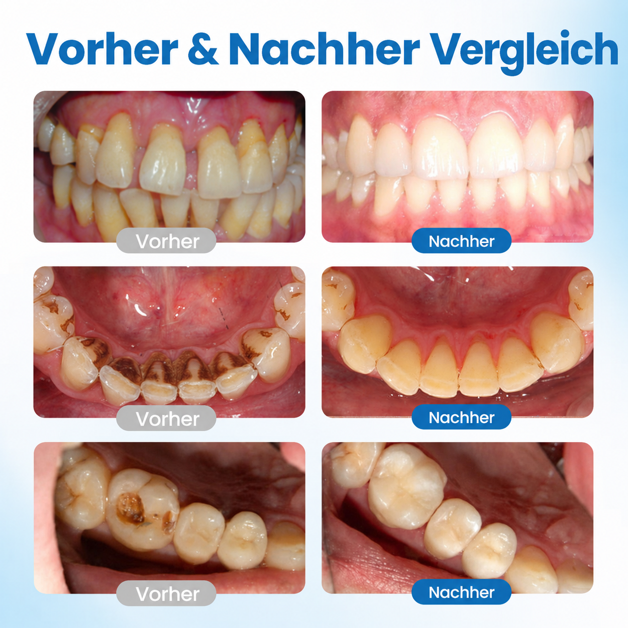 LBMLB™ | NanoHAP Zahnschutzserum
