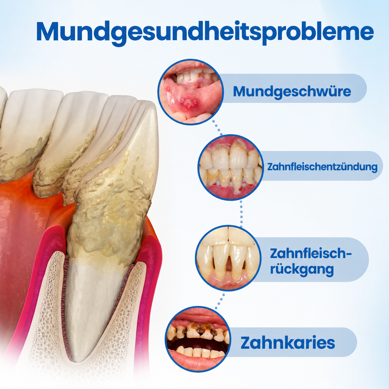 LBMLB™ | NanoHAP Zahnschutzserum