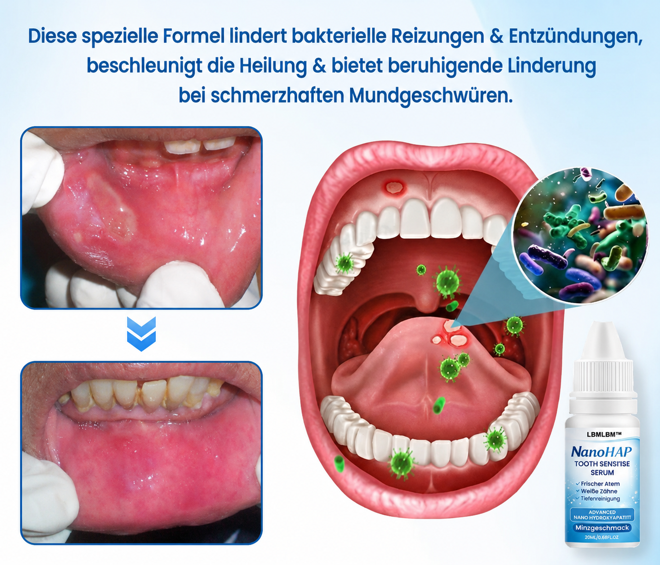 LBMLB™ | NanoHAP Zahnschutzserum