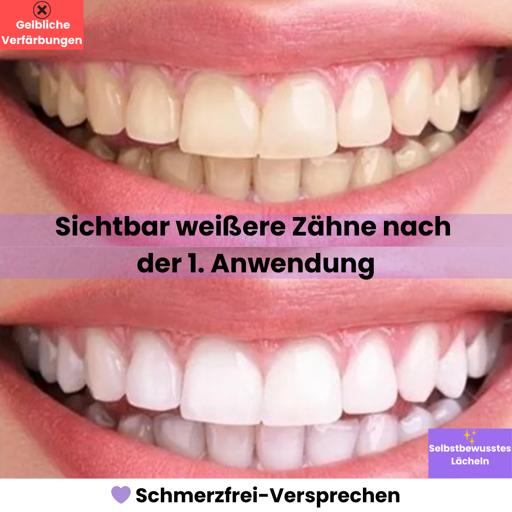 Farbkorrigierendes Zahnserum neutralisiert sofort Gelbtöne