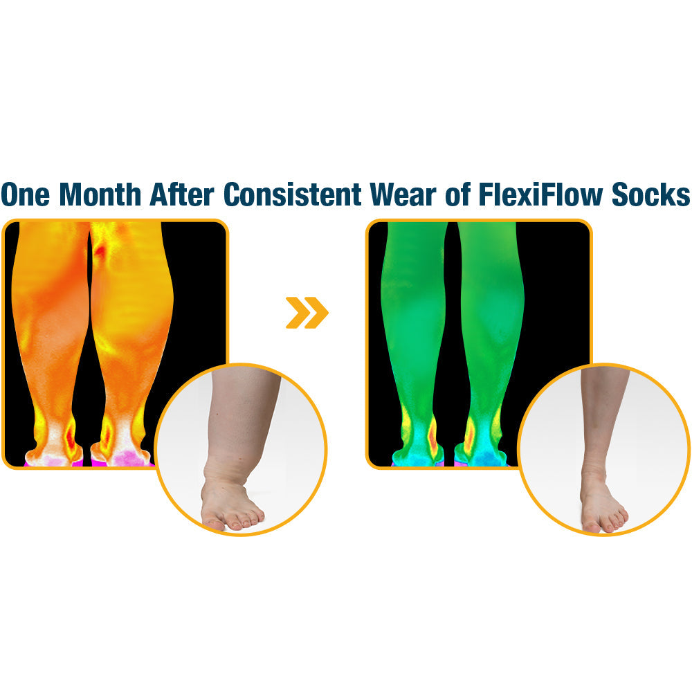 🧦 flysmus™ FlexiFlow – Hyper Stretch Kompressionssocken ohne Einschnürung