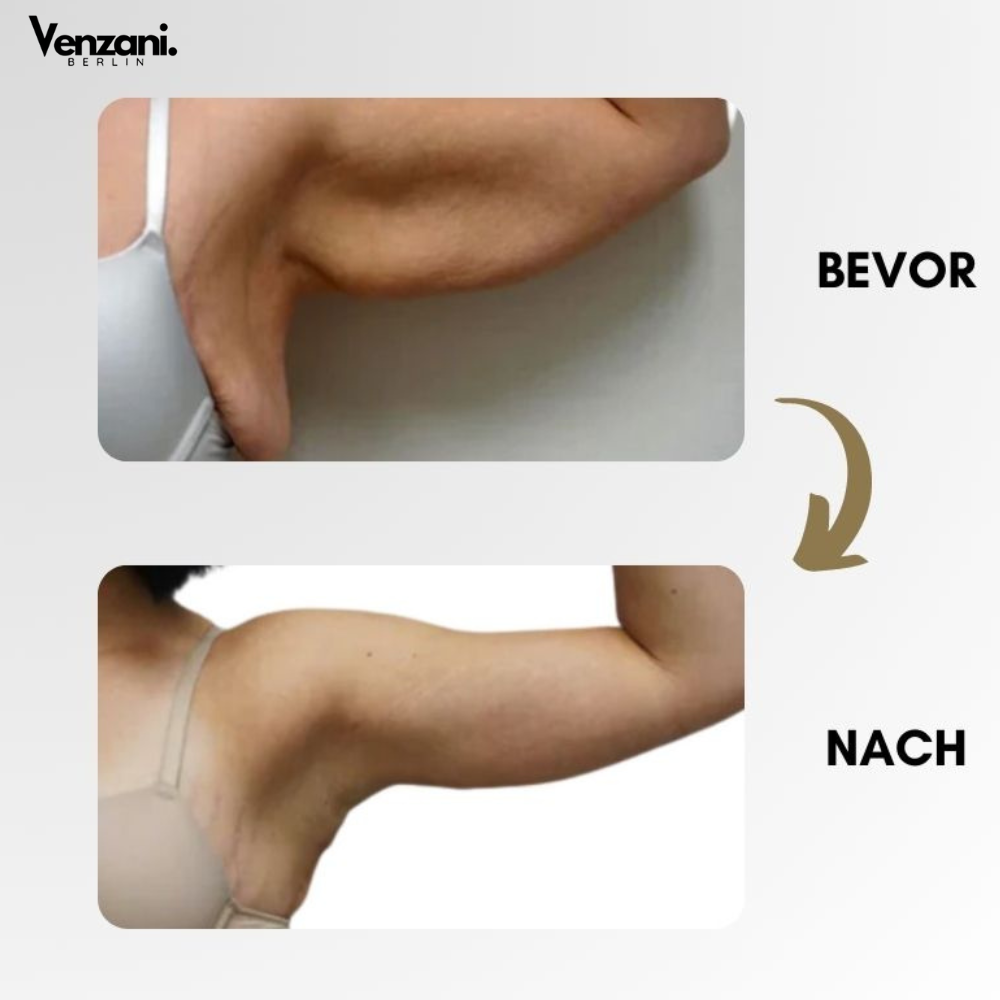 LETZTER TAG 50% RABATT | LymphMag™ | Sich in Wochen anders fühlen