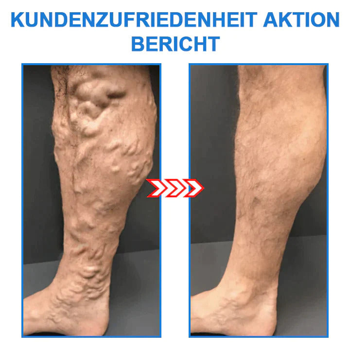 1+2 Gratis | FormSocken™ - Schlanke Beine und straffe Haut in einem Schritt!